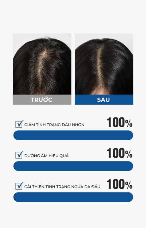 Dashu Daily Anti-Hair Loss Scalp chính hãng